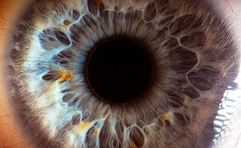 These 14 Incredible Photos Demonstrate The Complexity of The Human Eyes